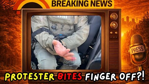 ICE Officer has finger bitten off by protester | TTN