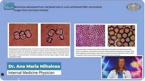 Dr. Ana Maria Mihalcea: "Self Assembling Nano technology In Live Blood“