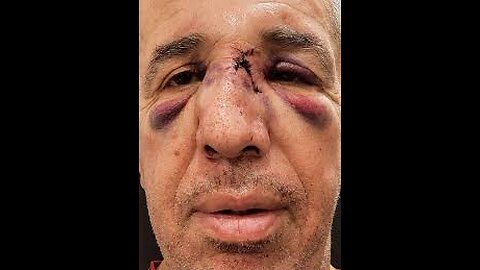 Agressé par le fils de sa victime, Mohamed Oulmekki, le toubib escroc, chouine à la TV [Flokossama]