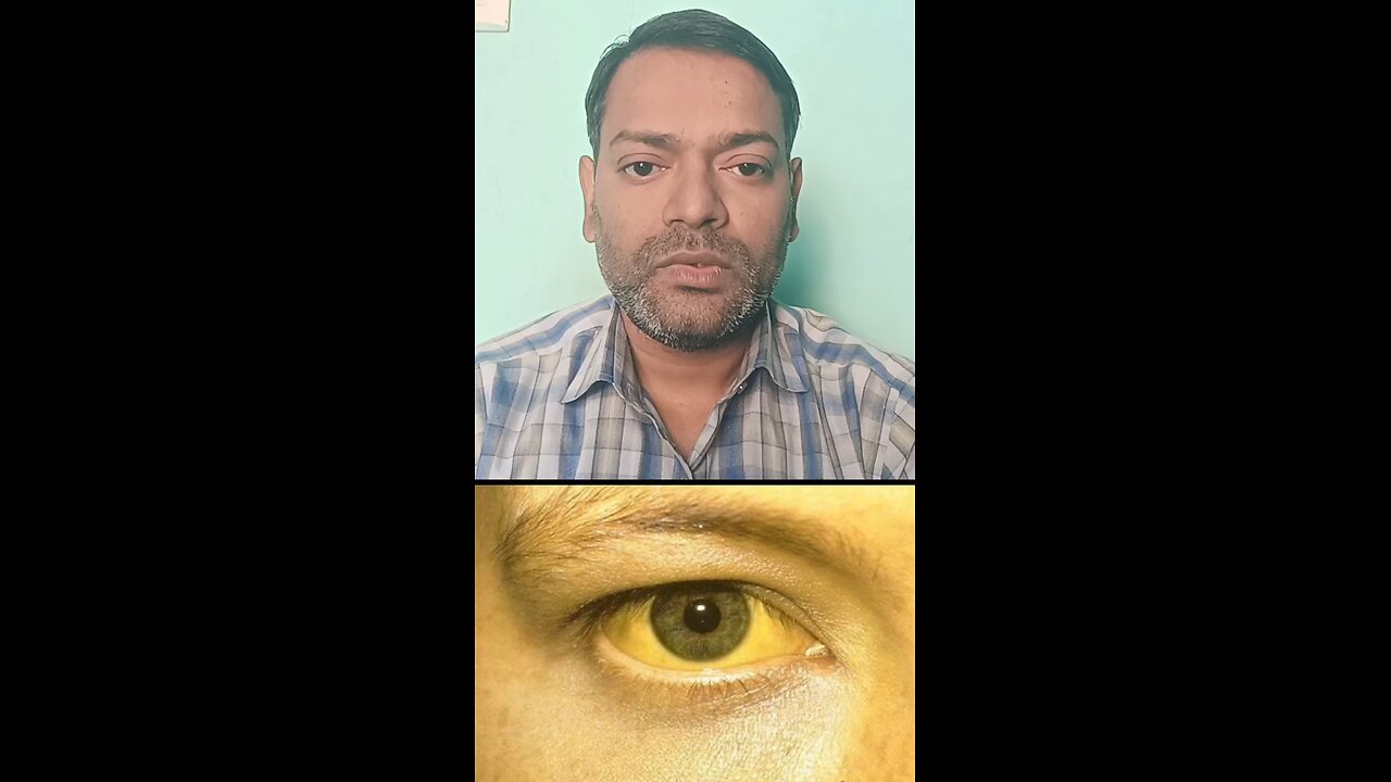 काला पीलिया किस बीमारी को कहते हैं ।