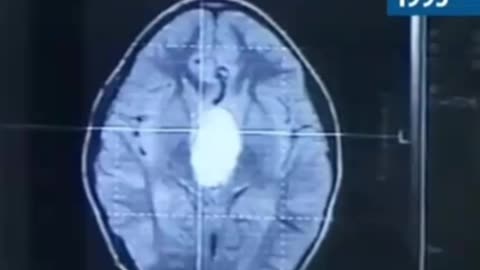 The Suppressed Cure They Don’t Want You to Know About