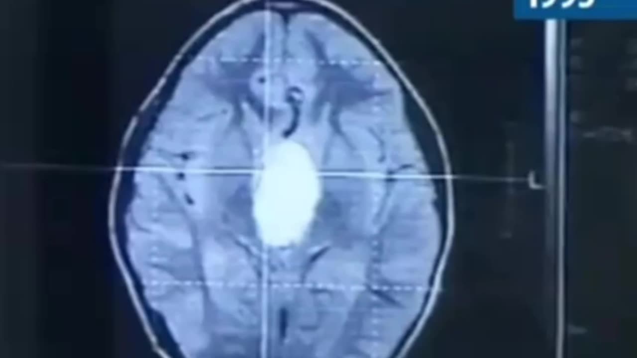 The Suppressed Cure They Don’t Want You to Know About