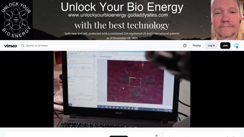Live blood test analysis, Part 2 - 10 days of heart attacks Ep 182 January 27, 2026