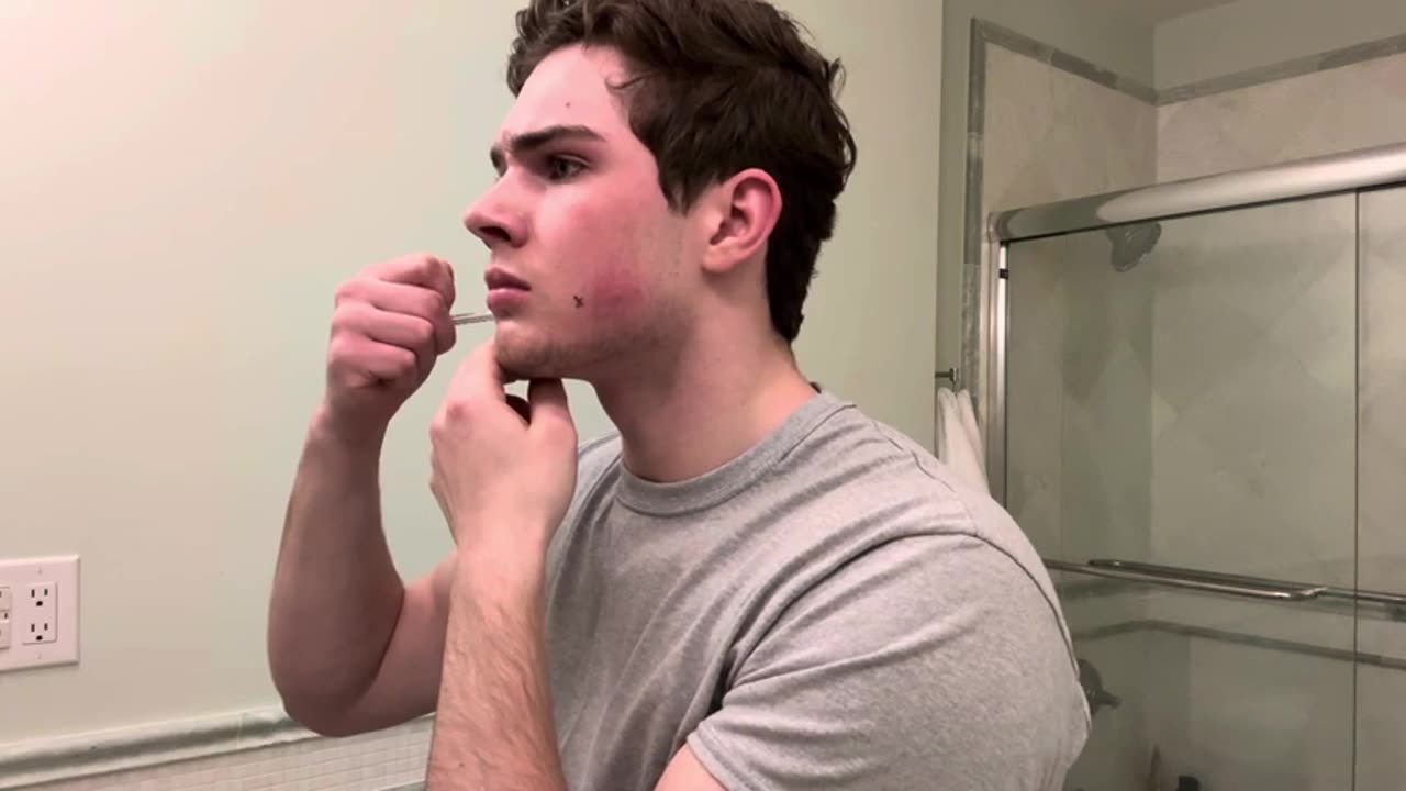 Autist tries DIY fat removal (deleted)