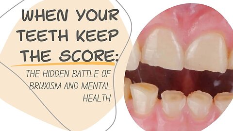 The Secret Link Between Teeth Grinding and Stress!