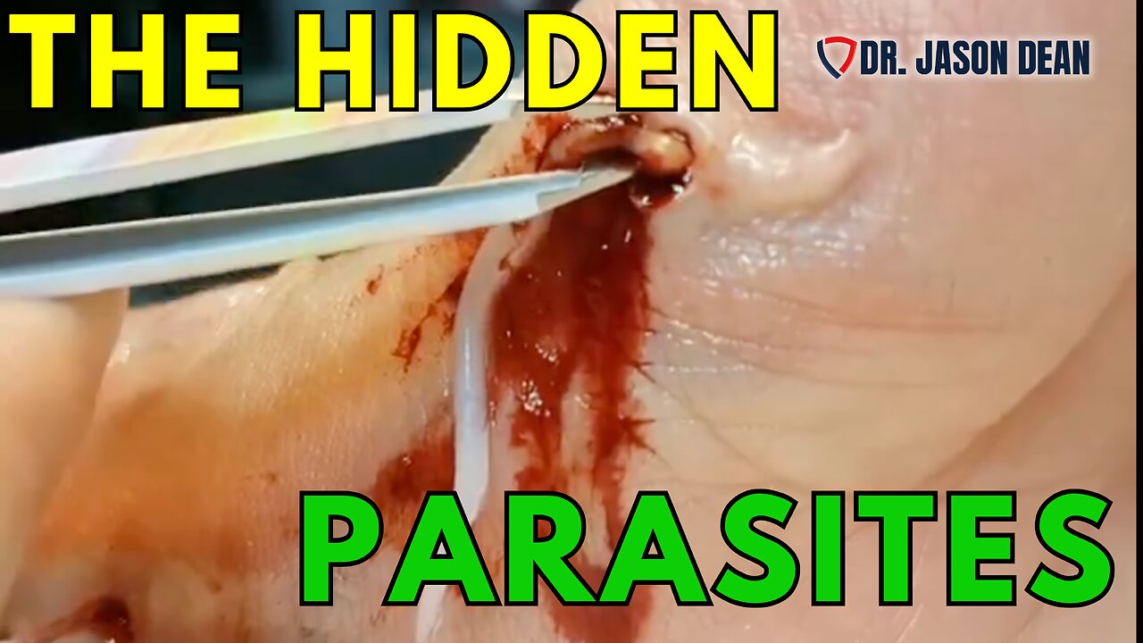 Dr. Jason Dean, BraveTV - Ep 1935 - The Hidden Parasites - Hidden Disease