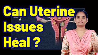 Treatment For Uterine Issues, Congenital Uterine, Womb Problems | Homeopathy, Medicine and Surgery