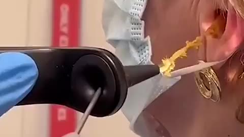 Ear Wax