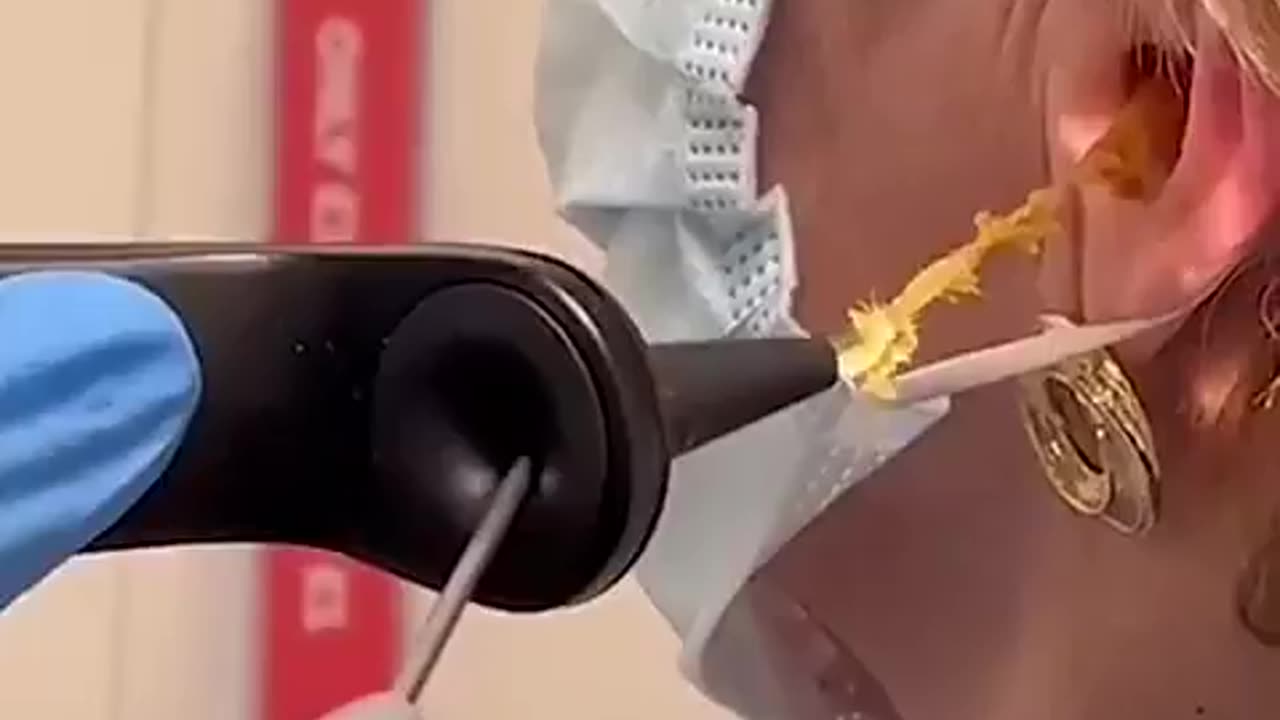 Ear Wax