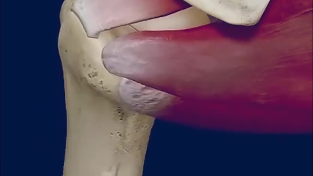 Rotator Cuff Repair Surgery (3D Animation)