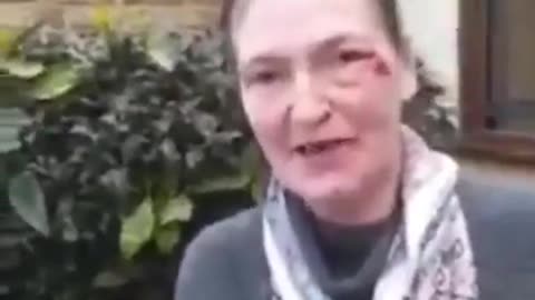 White Lady in London gets punched in the face ... we know by who