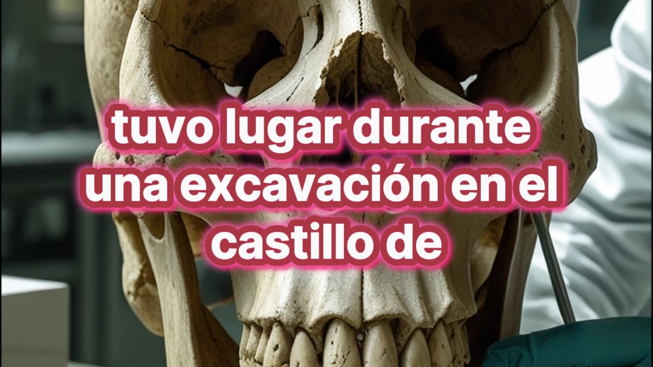 Identifican síndrome de Crouzon en un caballero de hace 600 años.