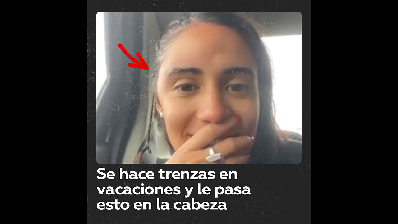 Se hace trenzas en vacaciones y le pasa esto en la cabeza