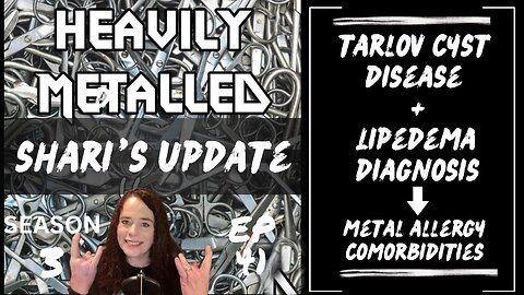 EP41-Shari’s Update-Metal Allergy. Comorbidities-Tarlov Cysts, Lipedema & Connective Tissue.