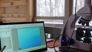 🚨🇺🇸 “This is how heavy Metals show up in the blood”