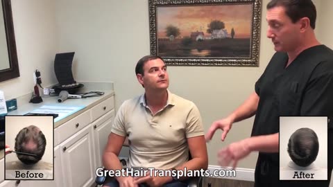 International Patient Dan Travels From Serbia for Dr. Bolton’s MaxHarvest™