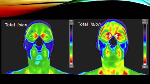 SVHI 2025.2 Thermography with Christine Horner, MD