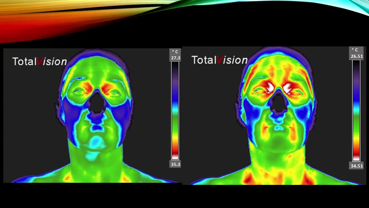 Thermography with Christine Horner, MD