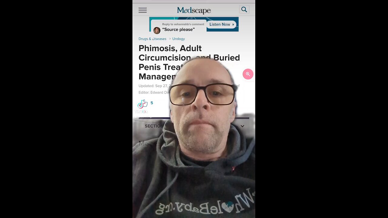 "Circumcision" for Phimosis?