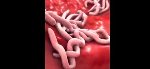 PARASITES AND DETOXING 🔥