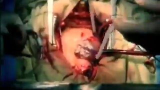 The Heart’s Code, there are dozens of these cases. Its not just an organ...