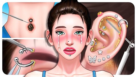 [ASMR] Refreshing Piercing Removal Compilation💎 Infection Treatment from Poor Aftercare