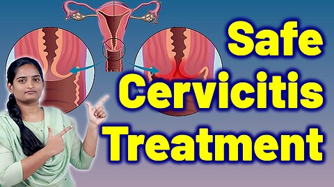 Cervicitis Treatment Solutions | Cervical Infection, Inflamed Cervix | Medicine Gynaecology Women