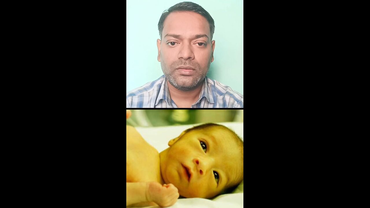 बच्चों के पीलिया का इलाज ।