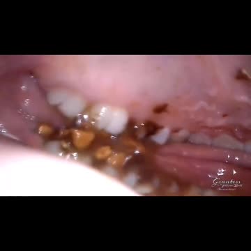 POV inside giantess mouth , giant woman eat a candy endoscope