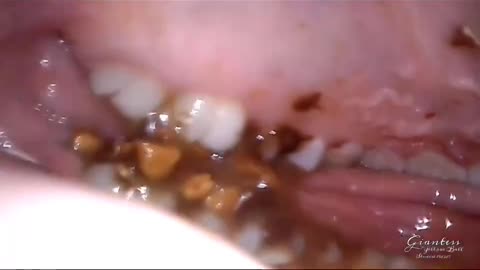 POV inside giantess mouth , giant woman eat a candy endoscope