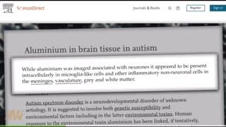Discovery of massive amounts of aluminum in brain tissue of boy died with autism