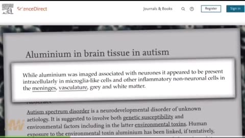 Discovery of massive amounts of aluminum in brain tissue of boy died with autism