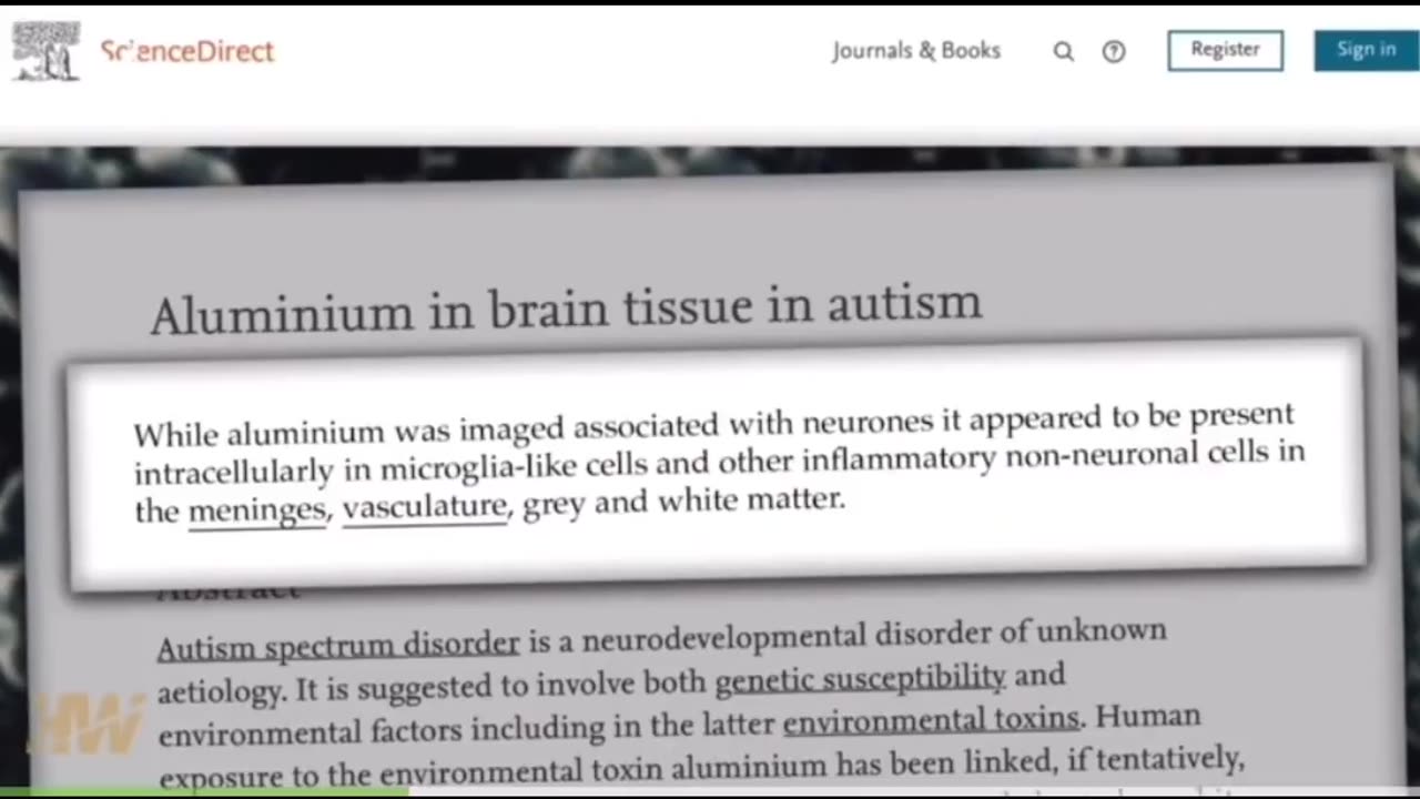 Discovery of massive amounts of aluminum in brain tissue of boy died with autism