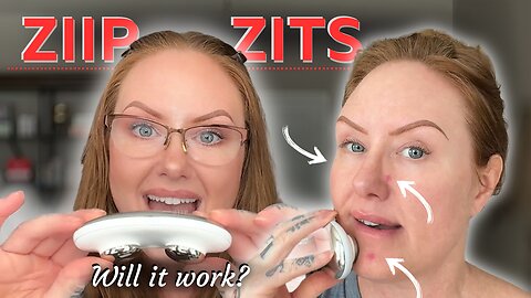 Can The ZIIP HALO Really GET RID Of PIMPLES?