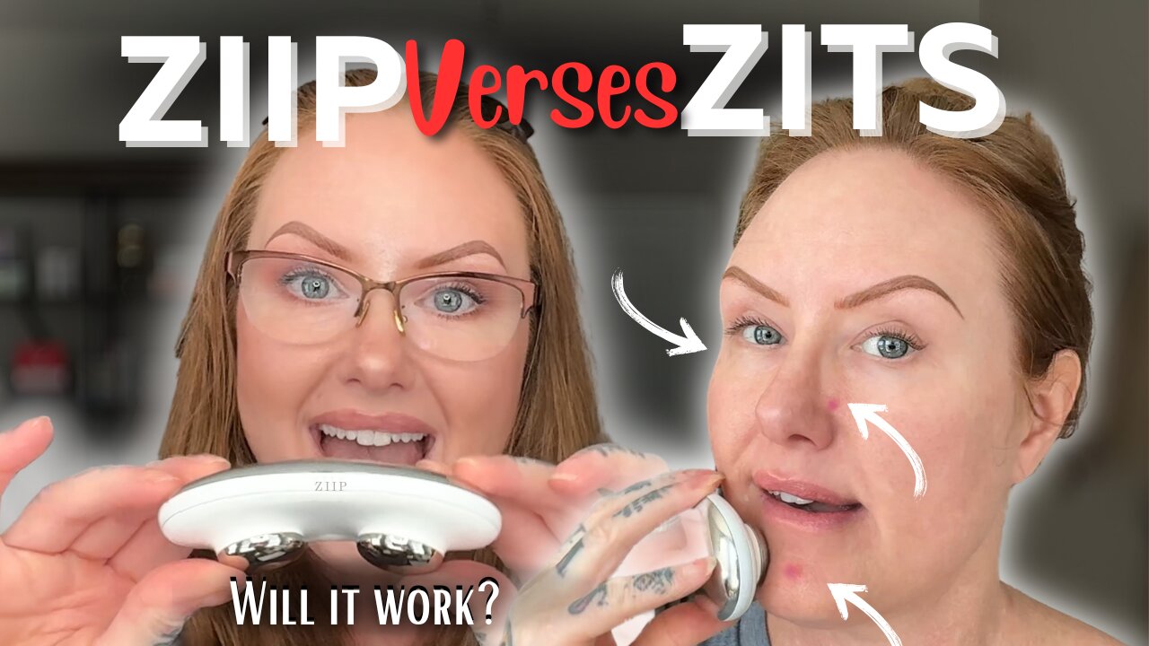 Can The ZIIP HALO Really GET RID Of PIMPLES?