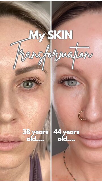 Products I Used to Transform My Skin