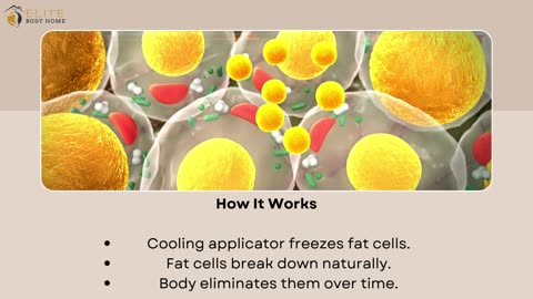 Fat Freezing CoolSculpting Dubai | Elite Body Home Polyclinic
