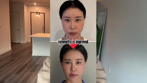 How Daily Face Yoga Habits Create Visible Facial Improvement | Koko Face Yoga