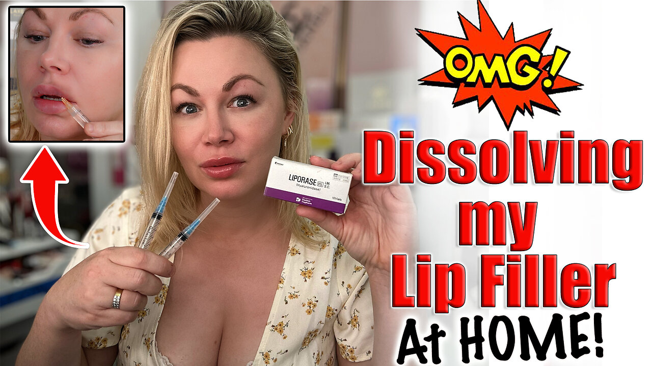 Dissolving my Lip FIller at Home with Liporase! AceCosm.com and code Jessica10 Saves