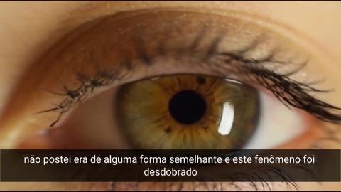 03.64. Inside-your-eyes-phenomenon_