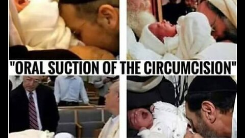 Metzitzah B’peh: Direct Oral Suctioning of baby's p*nis after Circumcision (A Jewish thing)