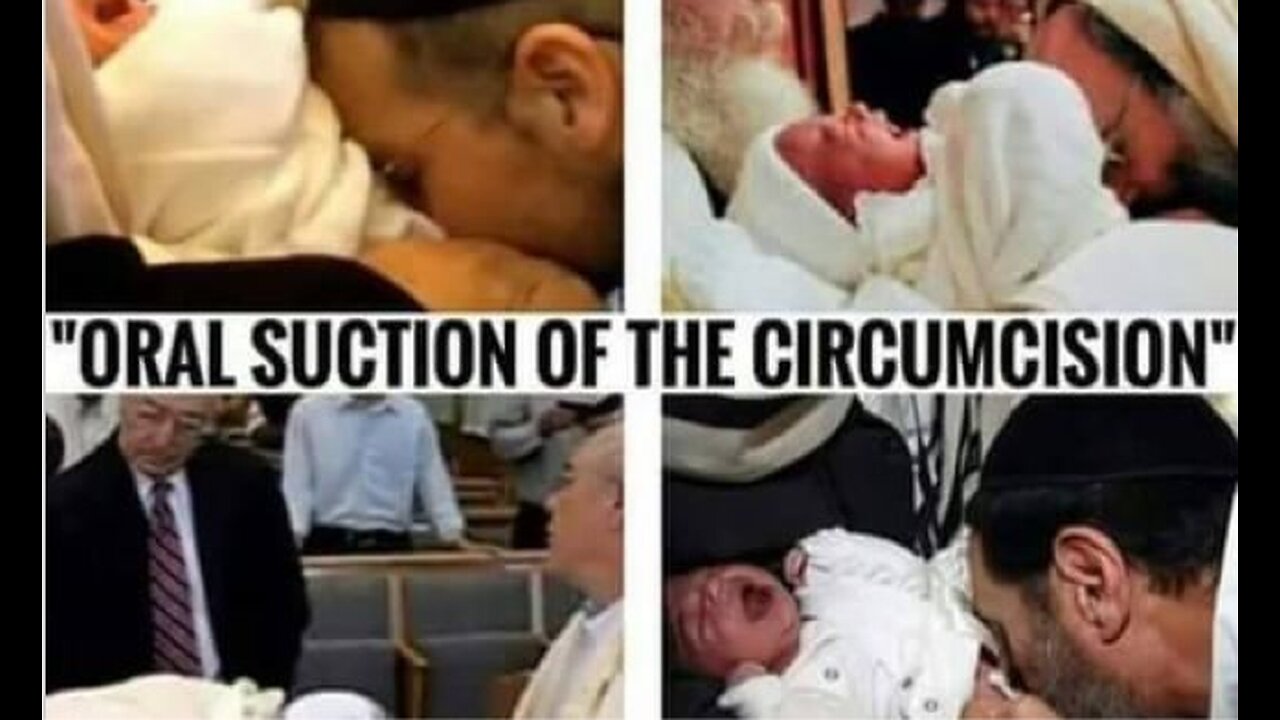 Metzitzah B’peh: Direct Oral Suctioning of baby's p*nis after Circumcision (A Jewish thing)