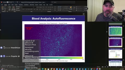 High Intensity Intervention to Reverse Amyloid Related Whole Blood Pathology – Latest Lab Updates