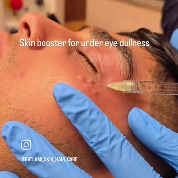 Revitalize Tired Eyes with Under-Eye Skin Boosters