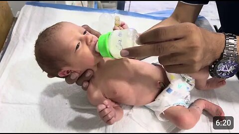 Nourishing Your Little Fighter: Feeding Your Preterm Baby with Confidence