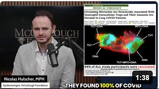 Amyloid microclots were found circulating in the blood of EVERYONE that received a COVID-19 "vaccine" in a new peer-reviewed study