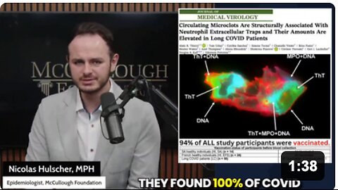 Amyloid microclots were found circulating in the blood of EVERYONE that received a COVID-19 "vaccine" in a new peer-reviewed study