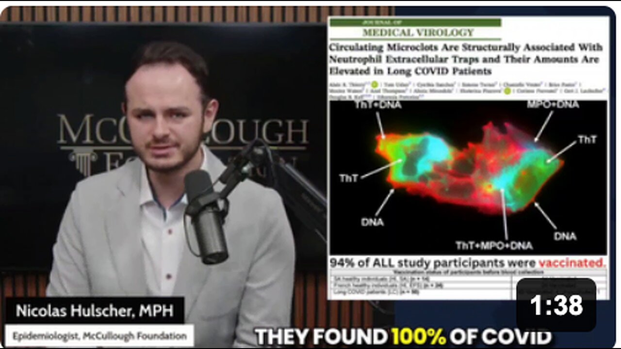 Amyloid microclots were found circulating in the blood of EVERYONE that received a COVID-19 "vaccine" in a new peer-reviewed study