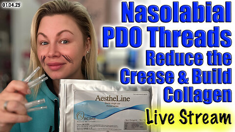 Live Nasolabial PDO Threads, Reduce Crease & Build Collagen, AceCosm.com | Code Jessica10 Saves