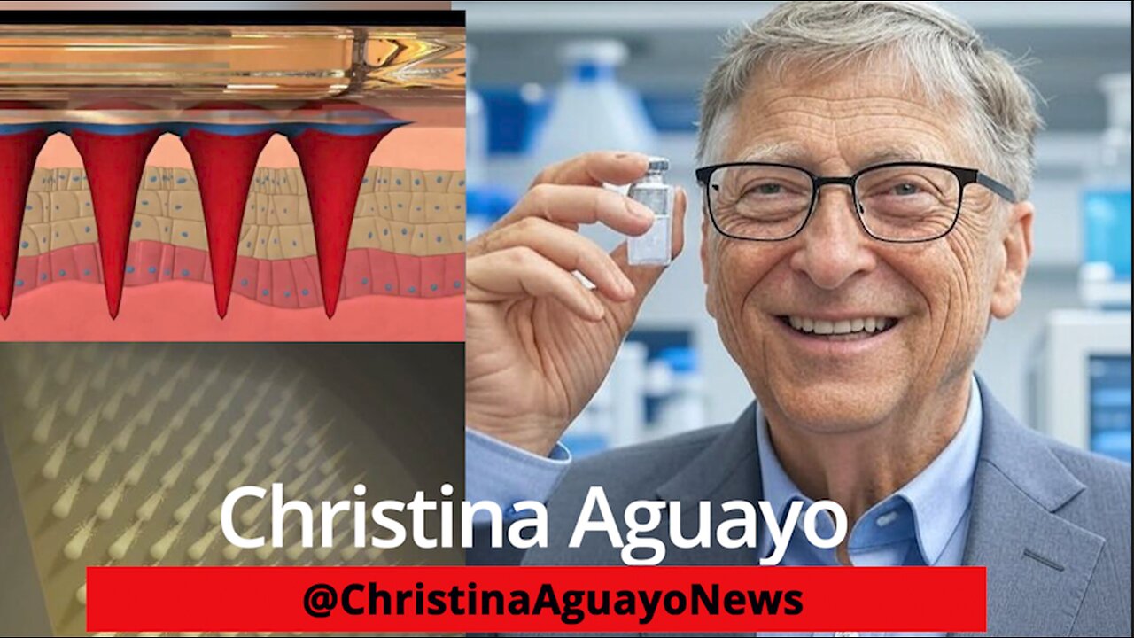 Bill Gates Funding Tech That Inserts mRNA Vaccines & Permanent Markings Under The Skin